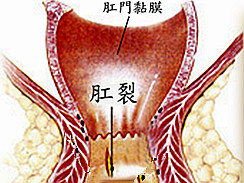 福州医博肛泰肛肠医院预约挂号