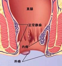 福州医博肛泰肛肠医院预约挂号