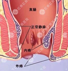 福州医博肛泰肛肠医院预约挂号