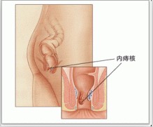 福州医博肛泰肛肠医院预约挂号