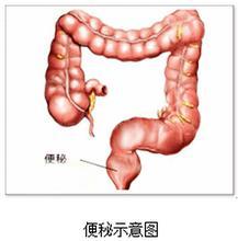 福州医博肛泰肛肠医院预约挂号