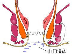 福州医博肛泰肛肠医院预约挂号