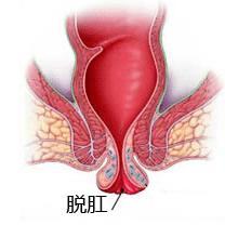 福州医博肛泰肛肠医院预约挂号