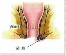 福州医博肛泰肛肠医院预约挂号