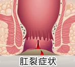 福州医博肛泰肛肠医院预约挂号