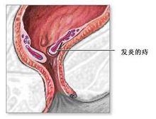 福州医博肛泰肛肠医院预约挂号