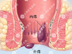 福州医博肛泰肛肠医院预约挂号