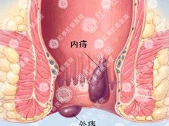 福州医博肛泰肛肠医院预约挂号