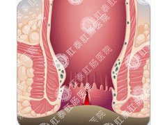 福州医博肛泰肛肠医院预约挂号