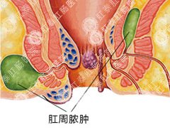 福州医博肛泰肛肠医院预约挂号