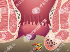 福州医博肛泰肛肠医院预约挂号