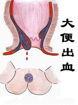 福州医博肛泰肛肠医院预约挂号
