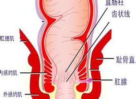 肛瘘有什么危害