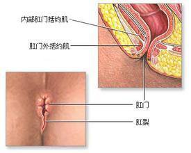 福州肛裂手术医博暖心效果好