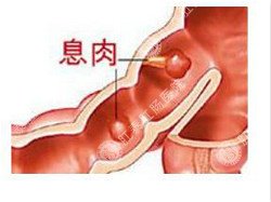 福州医博肛泰肛肠医院预约挂号