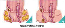 福州医博肛泰肛肠医院预约挂号