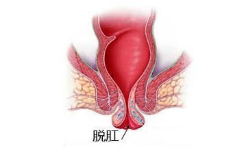 福州医博肛泰肛肠医院预约挂号