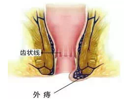 福州医博肛泰肛肠医院预约挂号