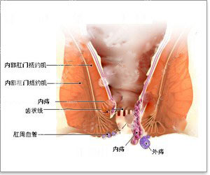 患上痔疮,肛门会痒吗?