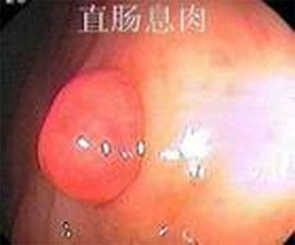 福州医博肛泰肛肠医院预约挂号