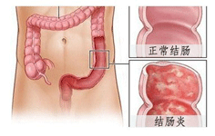 福州医博肛泰肛肠医院预约挂号