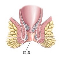 福州医博肛泰肛肠医院预约挂号