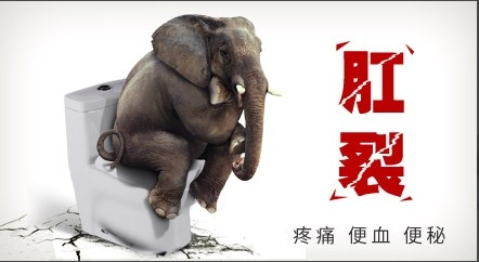 福州治疗肛裂的好方法哪种好